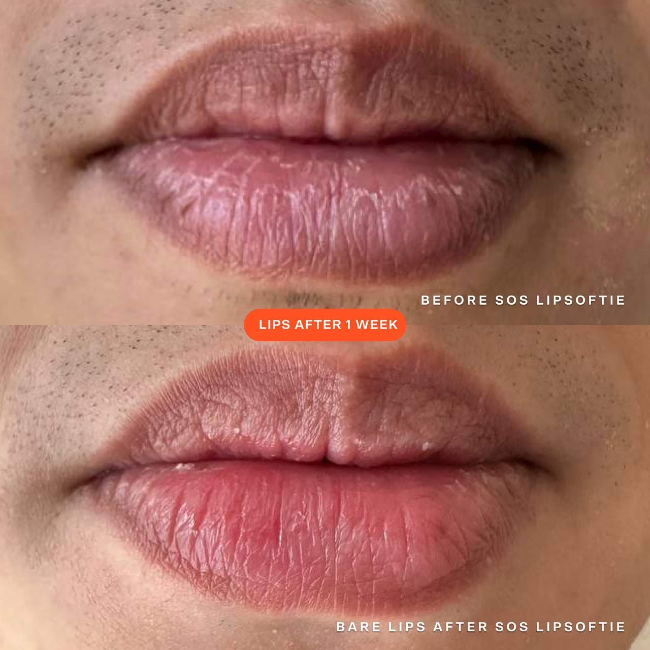 LipSoftie™ Hydrating Tinted Lip Treatment Balm - Tower28