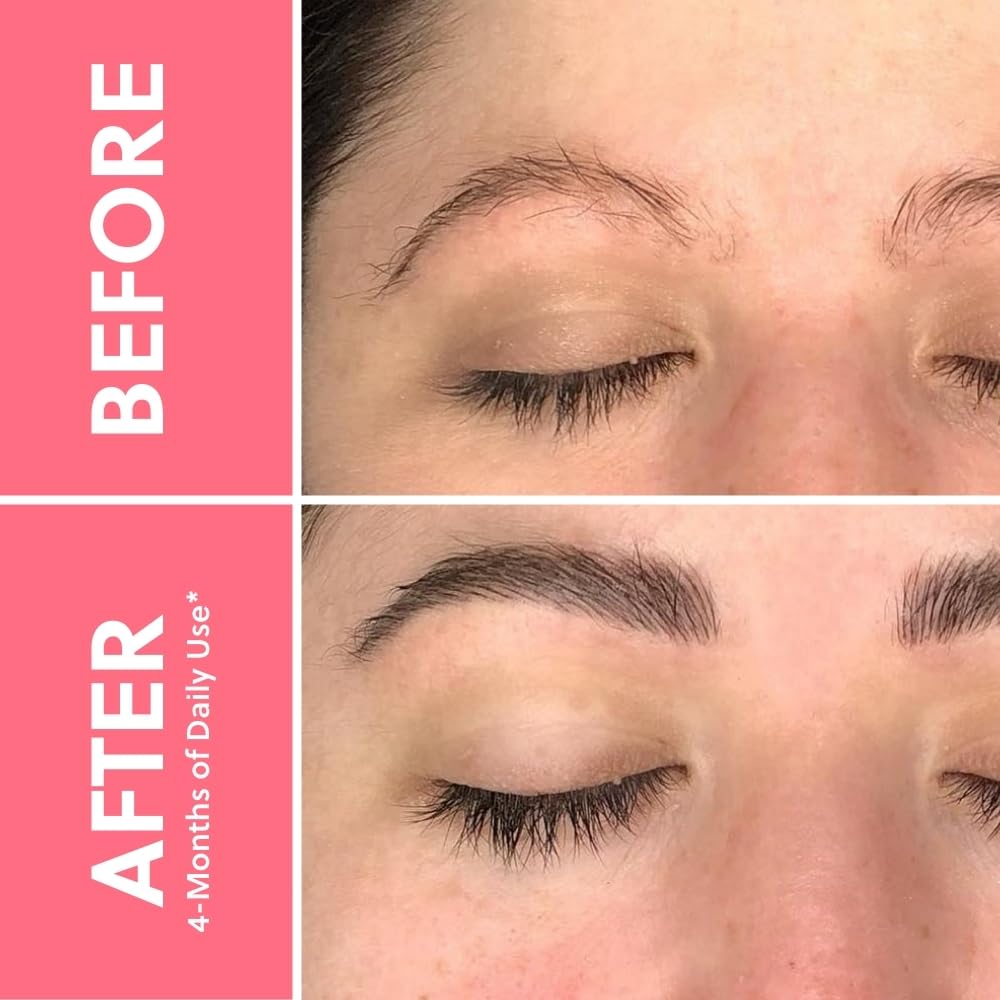 EYEBROW - FORCHICS