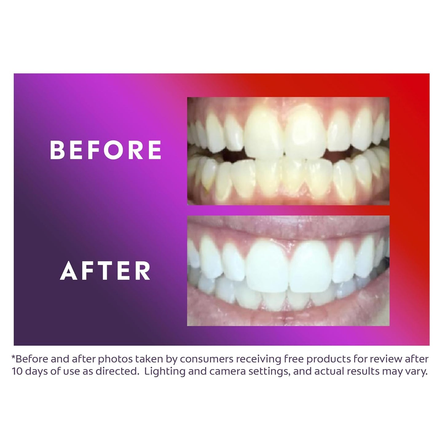 White ComfortFit Teeth Whitening Kit with LED Light and Whitening Pen - Colgate