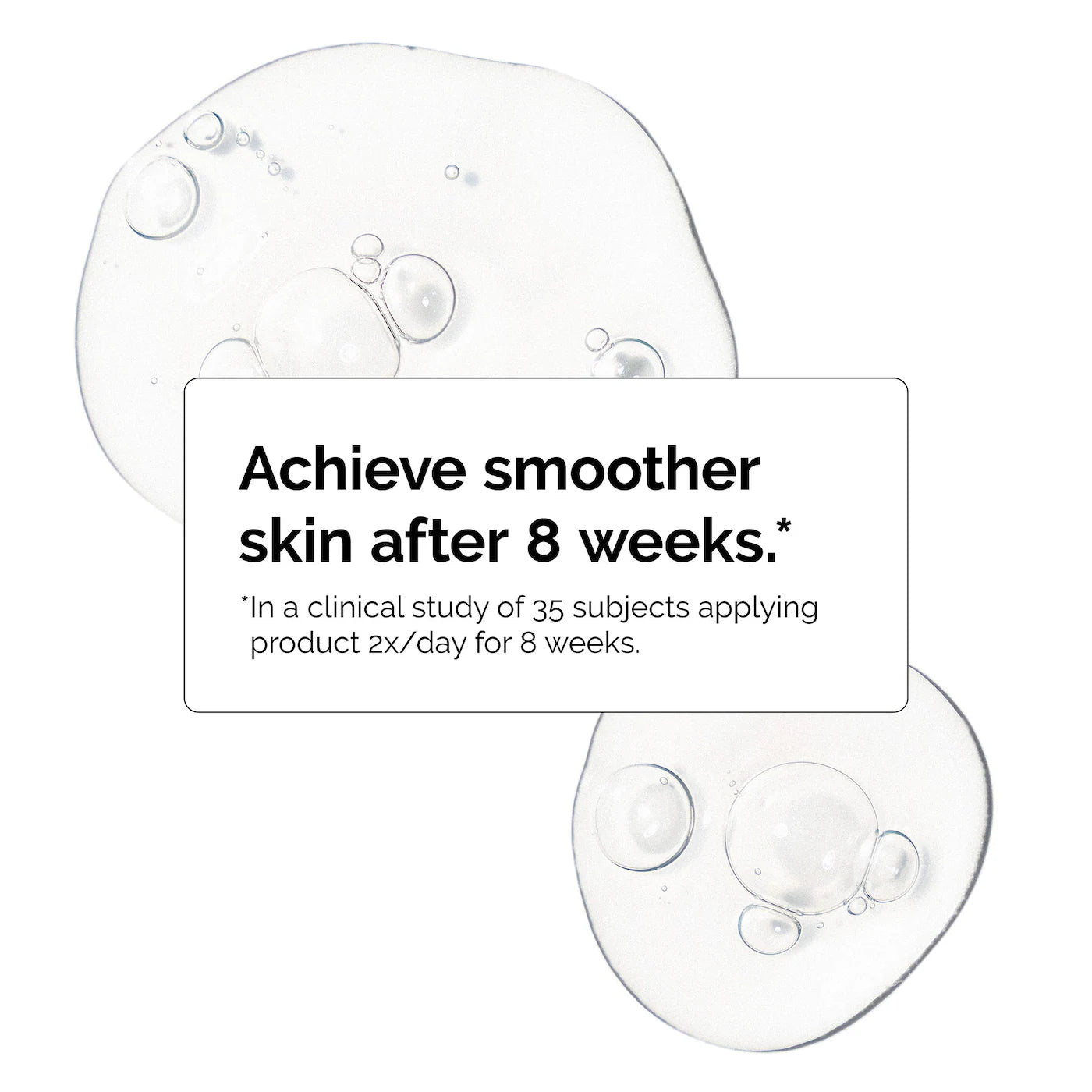 Niacinamide 10% + Zinc 1% Oil Control Serum - The Ordinary