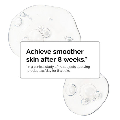 Niacinamide 10% + Zinc 1% Oil Control Serum - The Ordinary