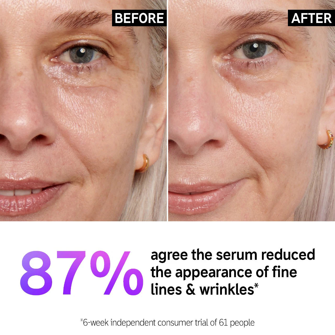 Retinol Fine Lines and Wrinkles Serum - The Inkey List