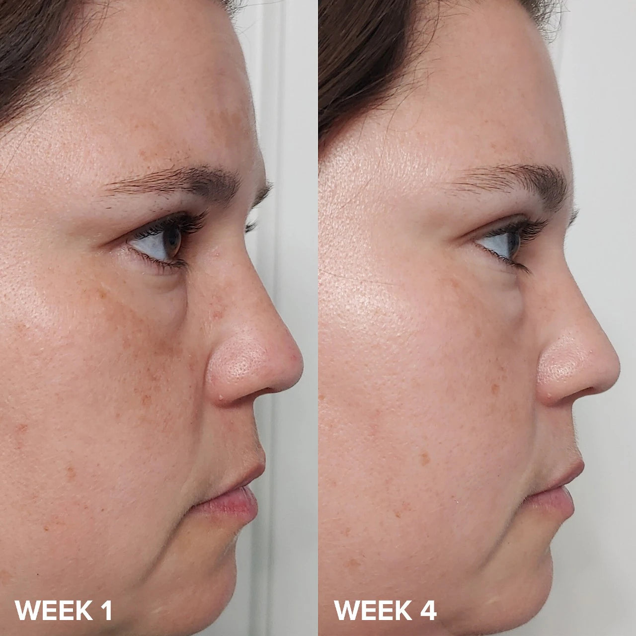 Mini Skin Perfecting 2% BHA Liquid Exfoliant - Paula's Choice