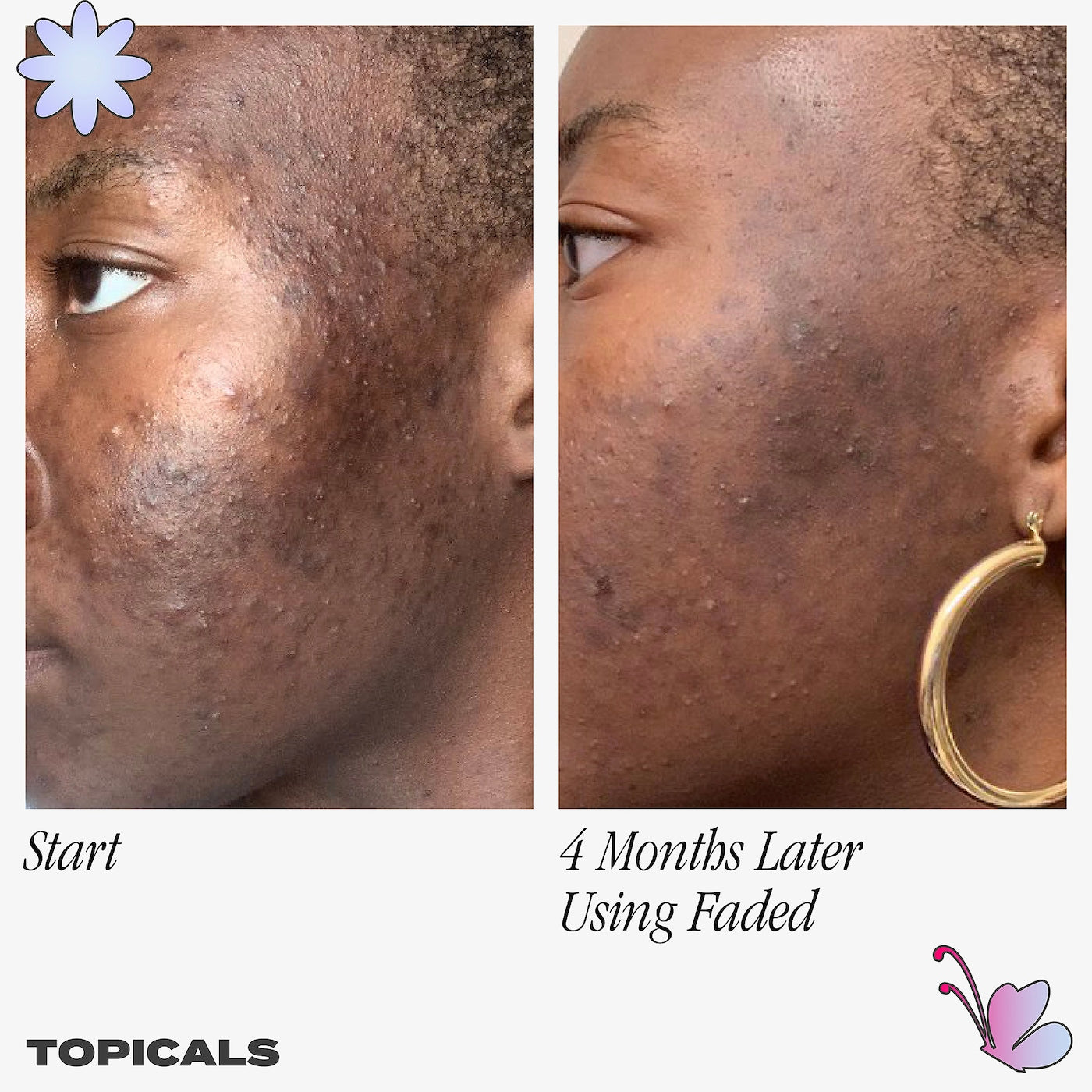 Faded Serum for Dark Spots & Discoloration - Topicals