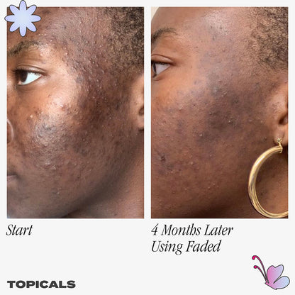 Faded Serum for Dark Spots & Discoloration - Topicals