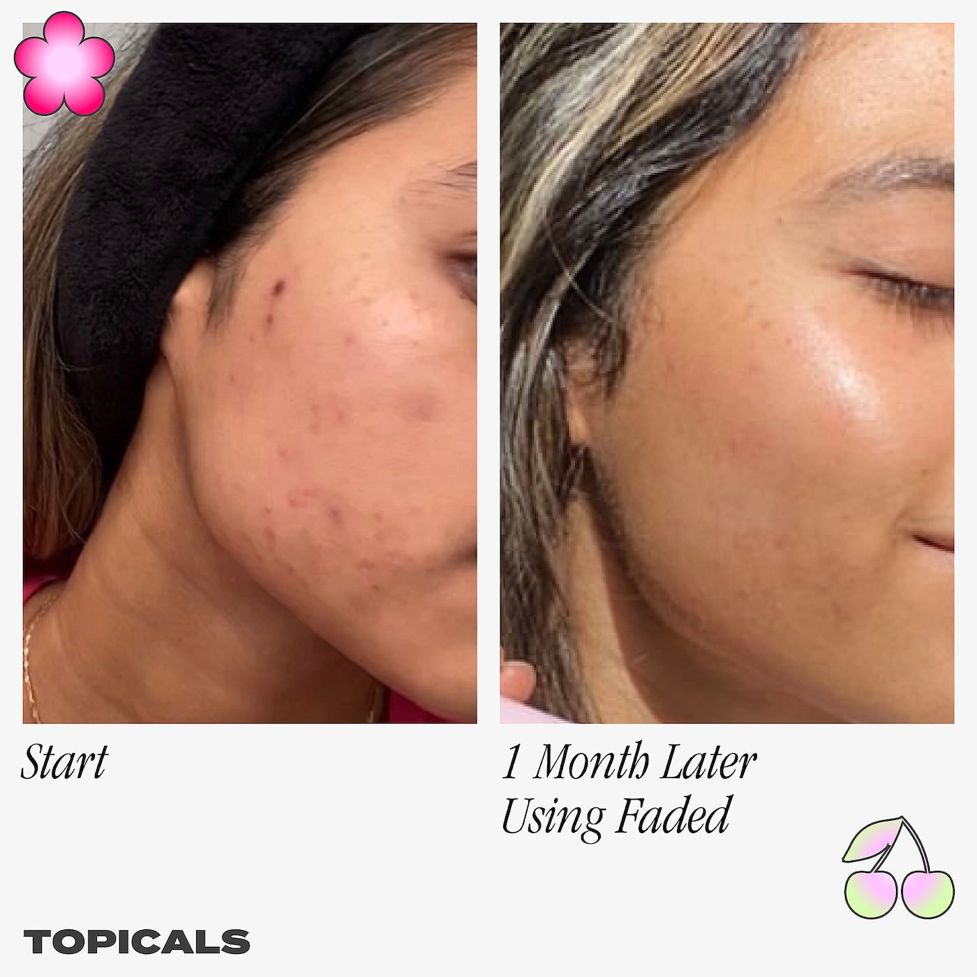 Faded Serum for Dark Spots & Discoloration - Topicals