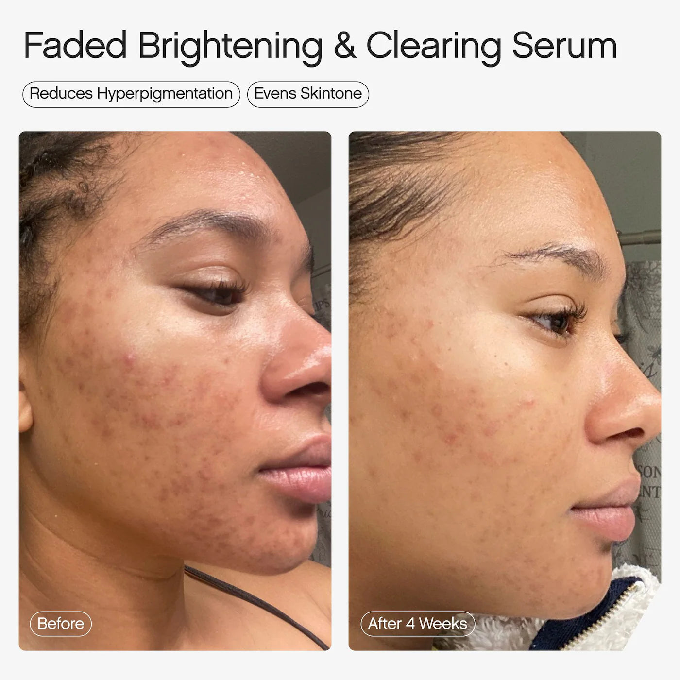 Faded Serum for Dark Spots & Discoloration - Topicals