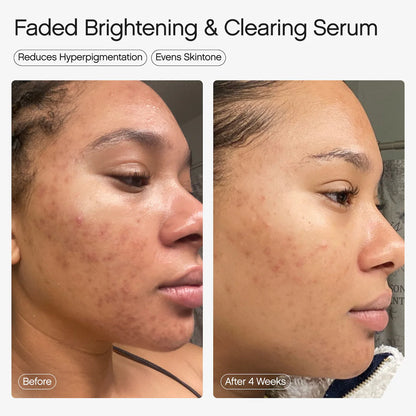Faded Serum for Dark Spots & Discoloration - Topicals
