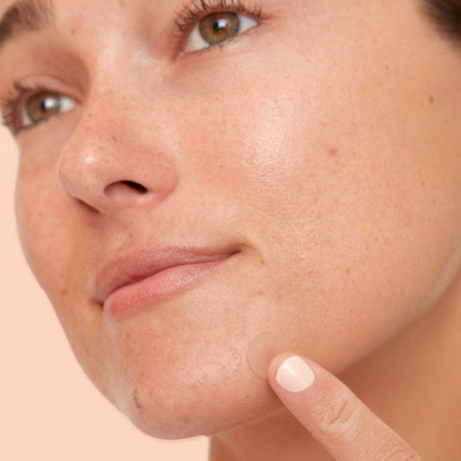 Salicylic Acid Acne Healing Dots - Peace Out