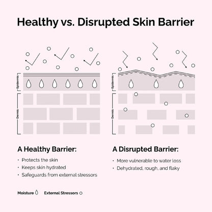 Soothing & Barrier Support Serum - The Ordinary
