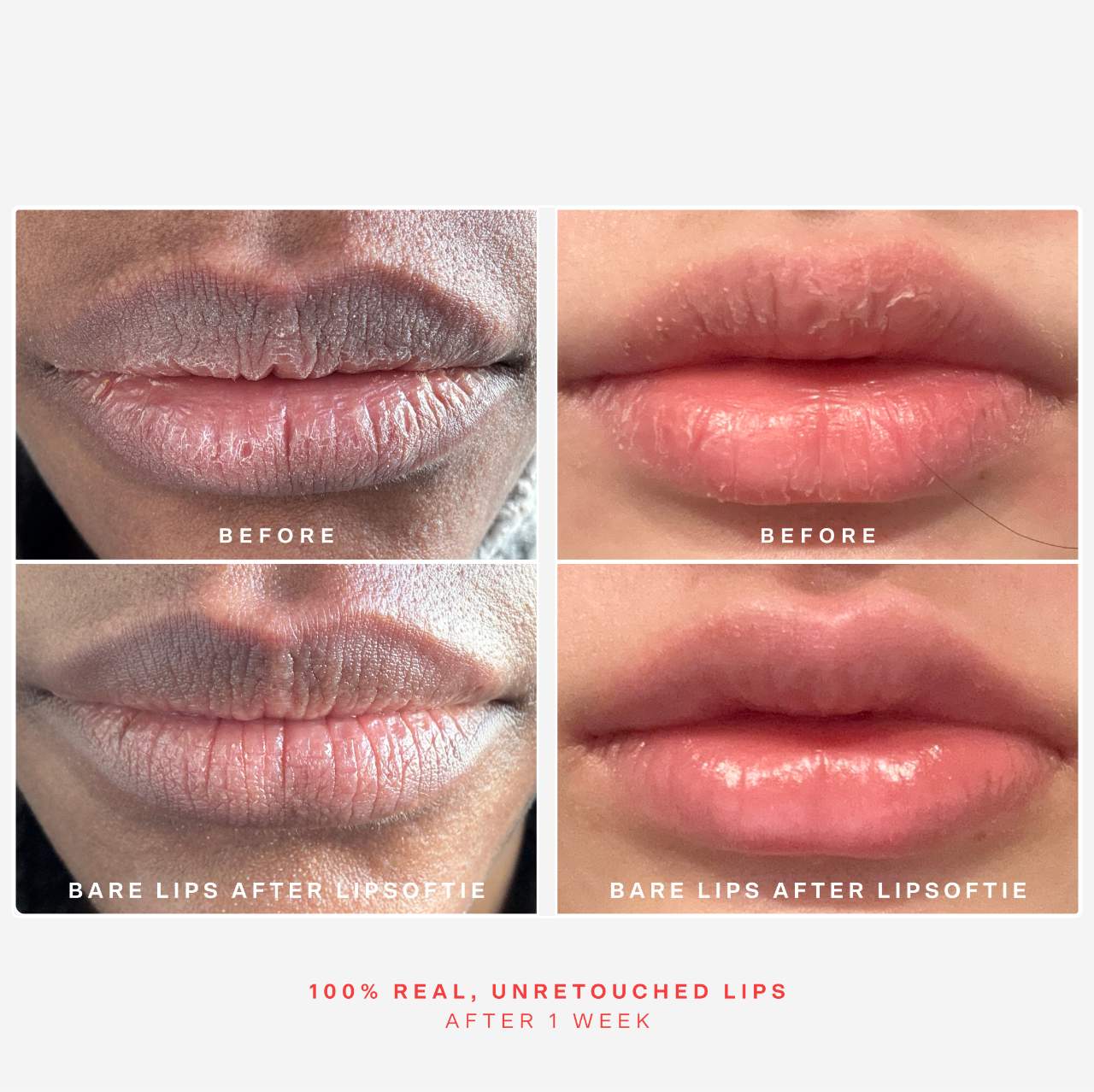LipSoftie™ Hydrating Tinted Lip Treatment Balm - Tower28