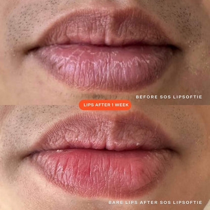 LipSoftie™ Hydrating Tinted Lip Treatment Balm - Tower28