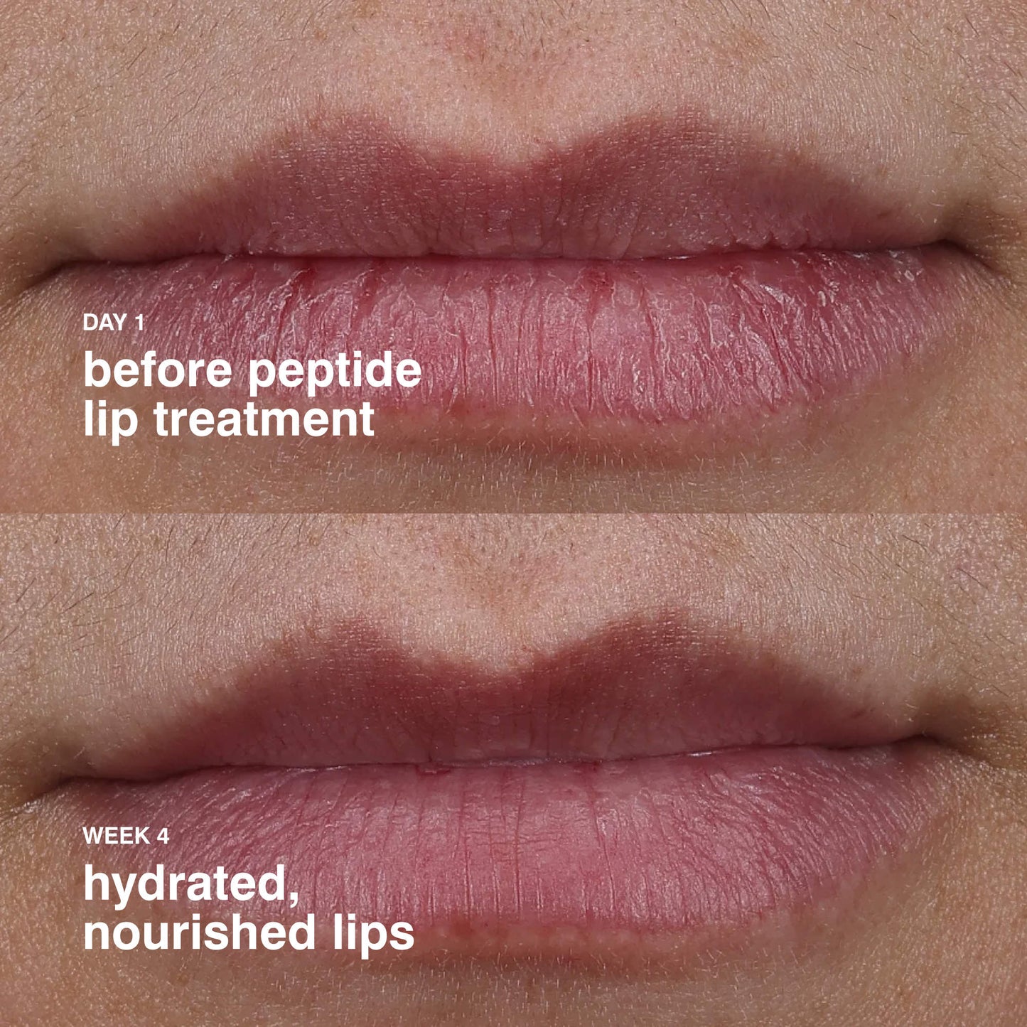 Peptide Lip Treatment Nourishing Glaze - Rhode