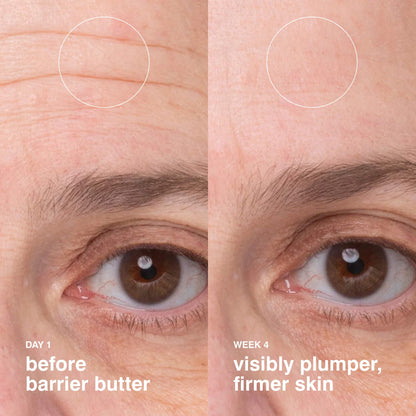 Barrier Butter Intensive Moisture Balm - Rhode